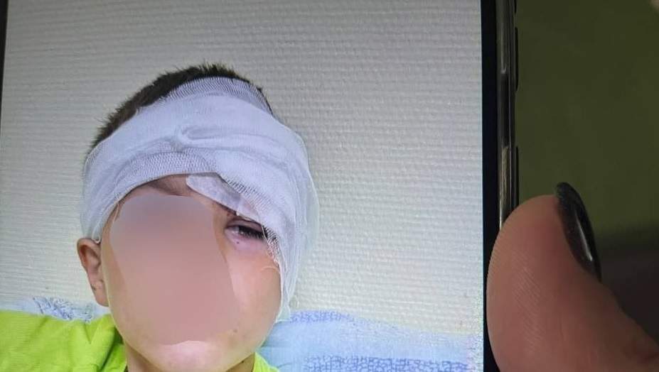 «Виднелись кости черепа»: подробности нападения на ребёнка в Приморье 