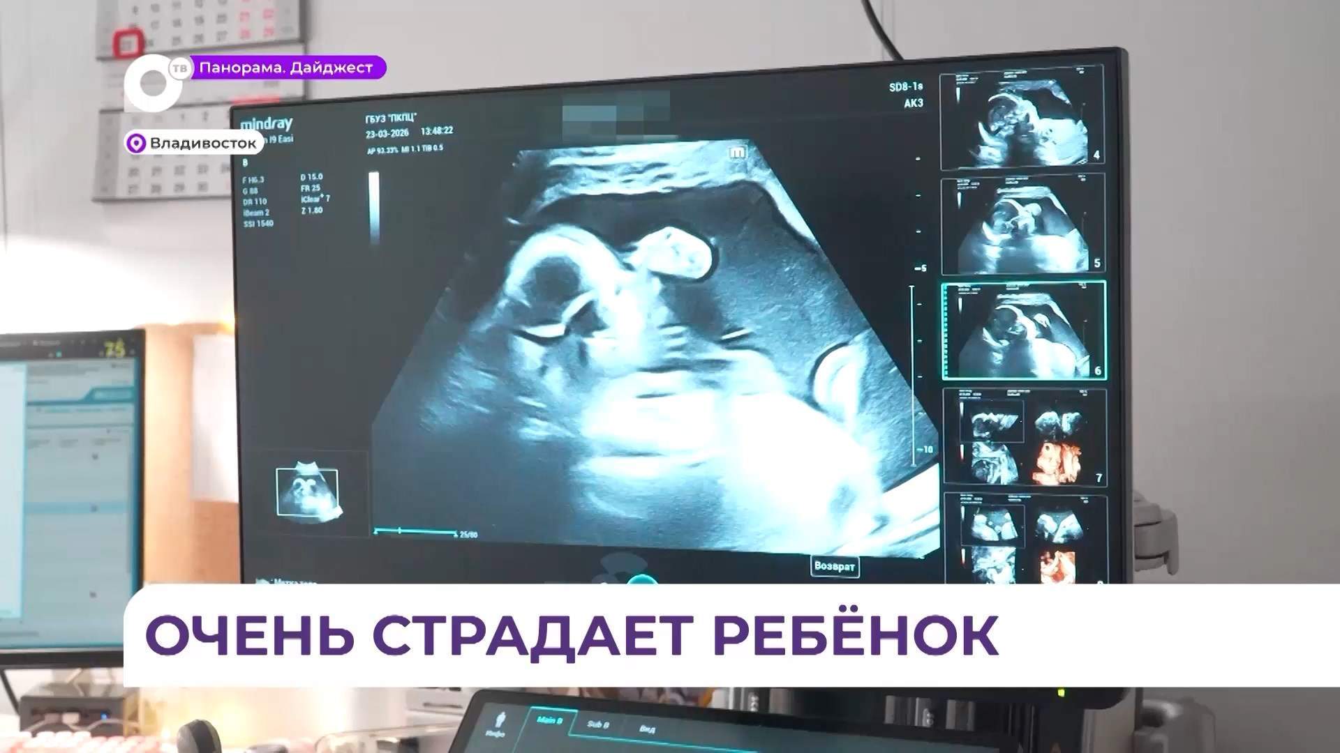 Беременную женщину с редким диагнозом доставили из Лучегорска в Приморский перинатальный центр