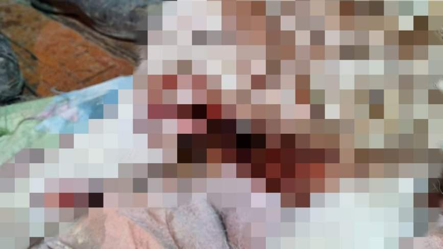 «Оторвали кожу и лопатку от тела»: ночное нападение произошло в Приморье