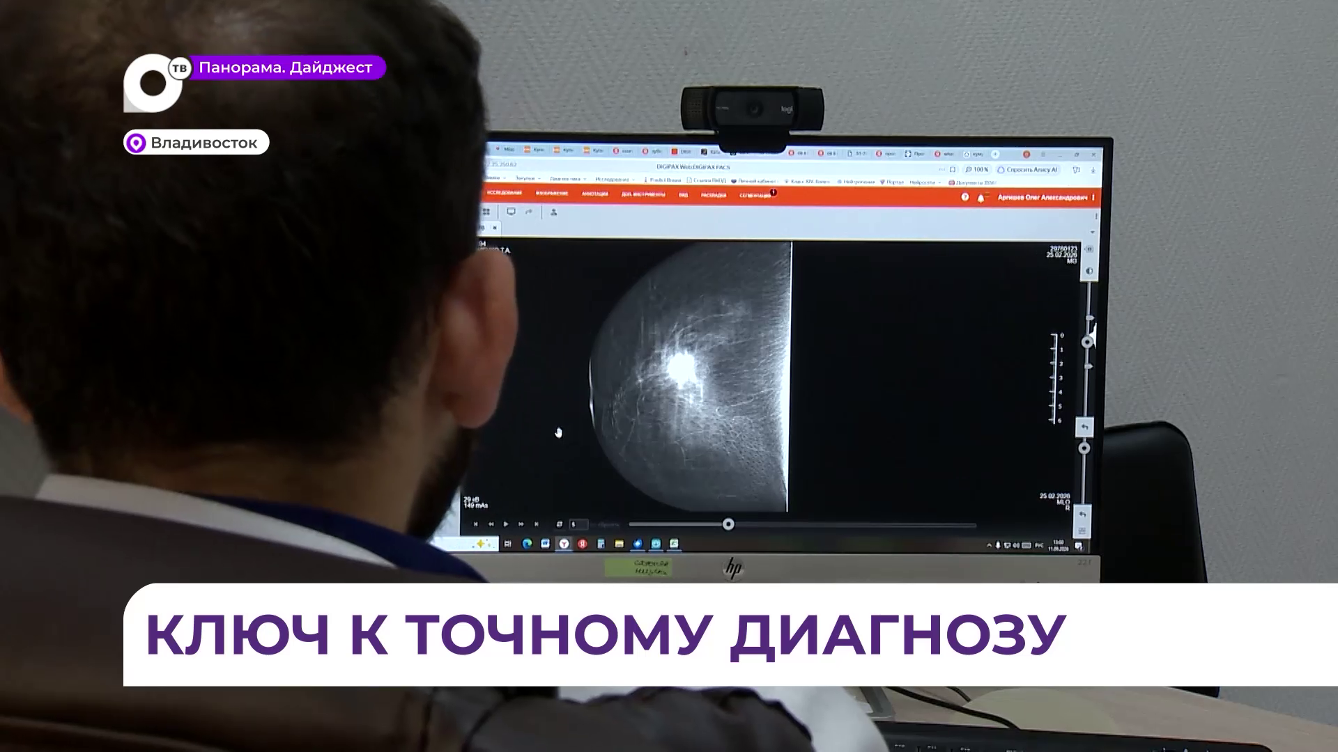 Приморские онкологи делают всё, чтобы выявлять рак молочной железы на ранних стадиях