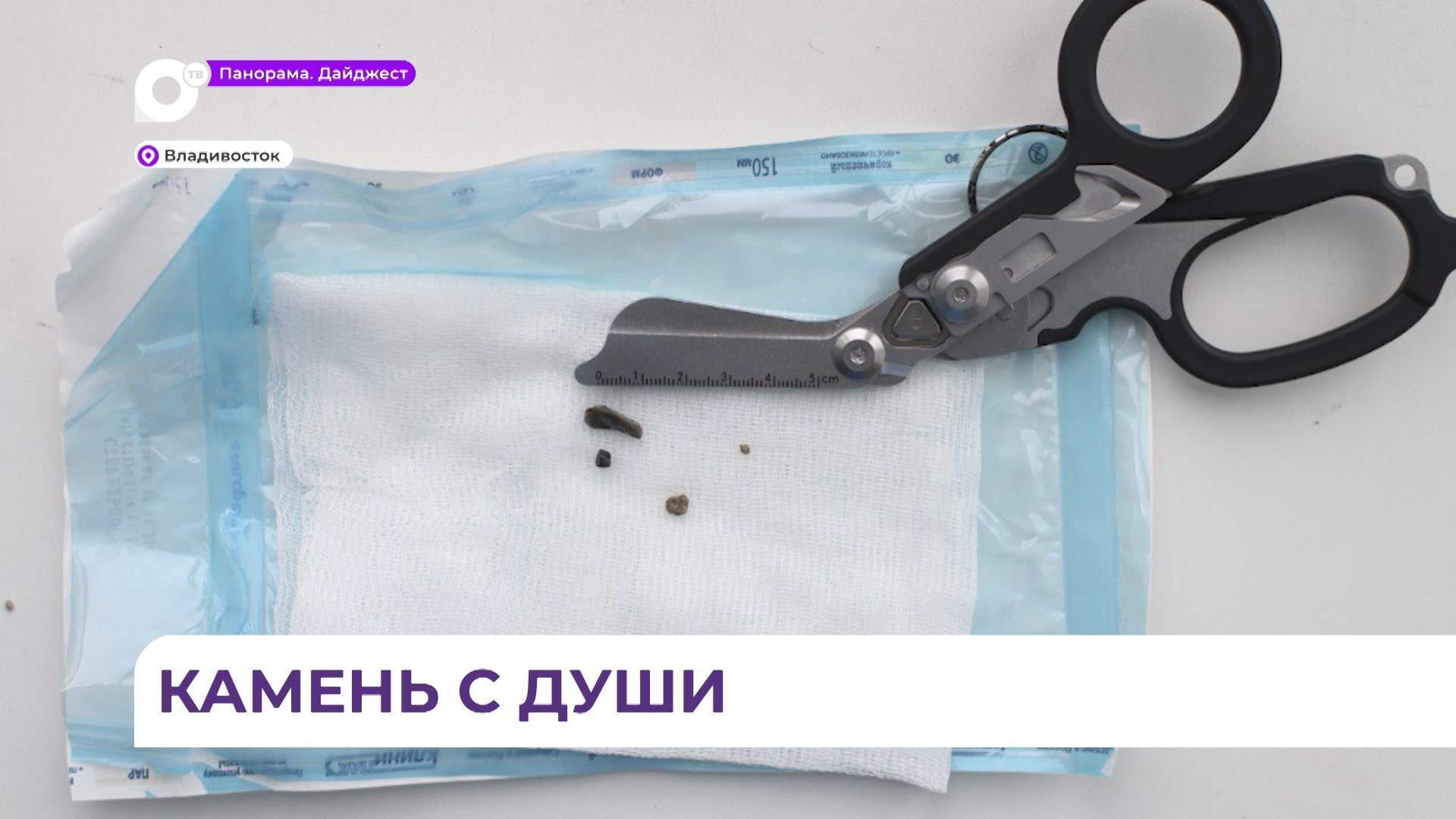 Несколько камней достали из трахеи трехлетней девочки во Владивостоке