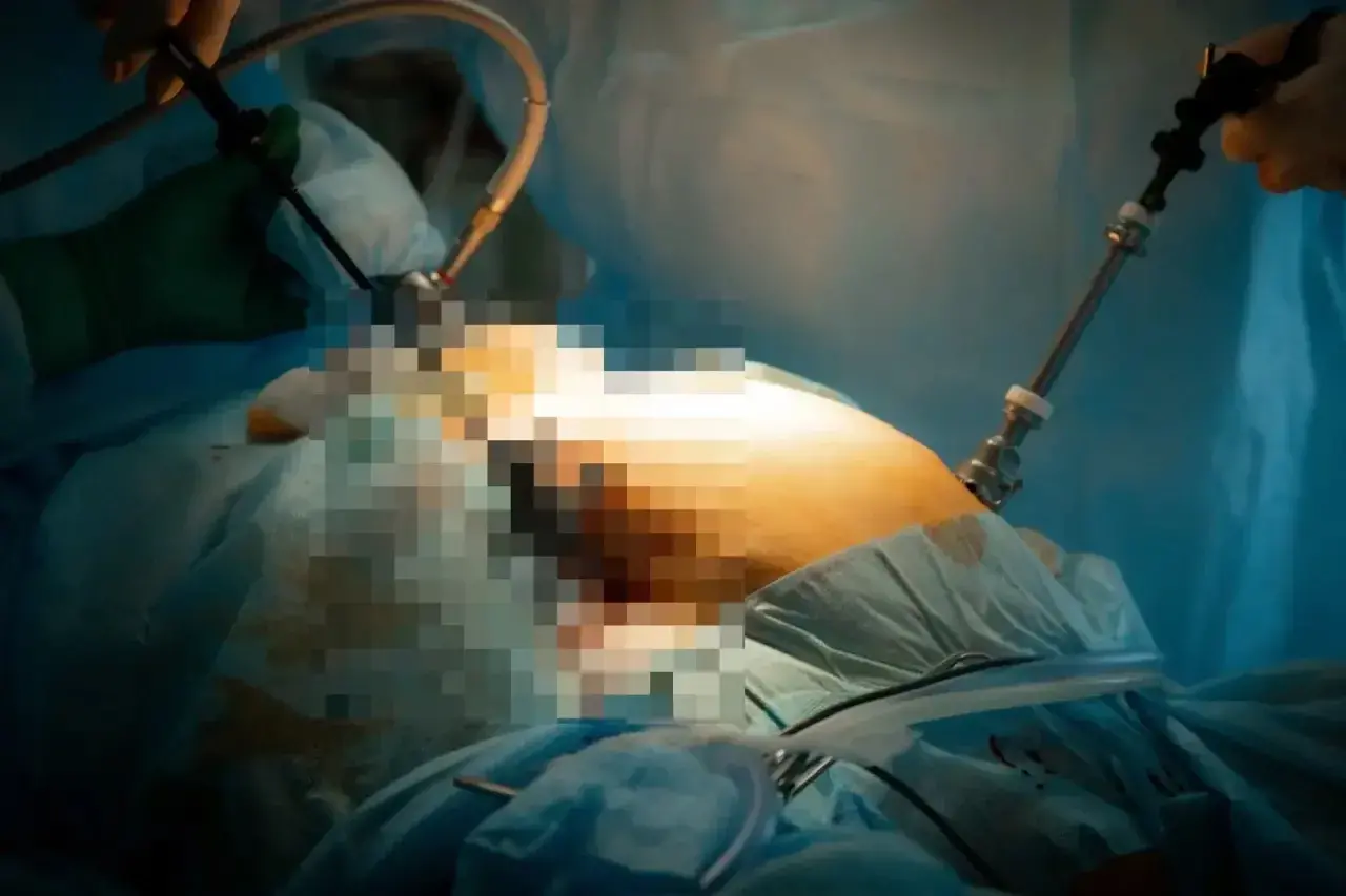 В приморской больнице из женщины извлекли нечто огромное