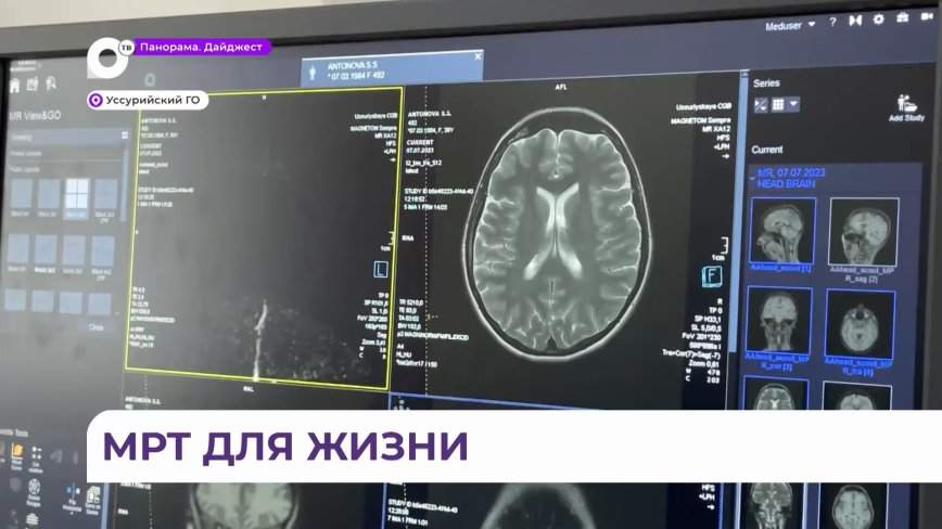 Рак и тромбозы теперь выявляют вовремя: в больнице Уссурийска – новый аппарат МРТ