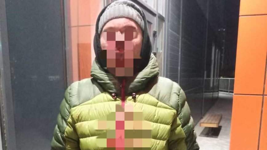 Во Владивостоке хозяин коттеджа сломал нос мужчине из-за собаки — видео