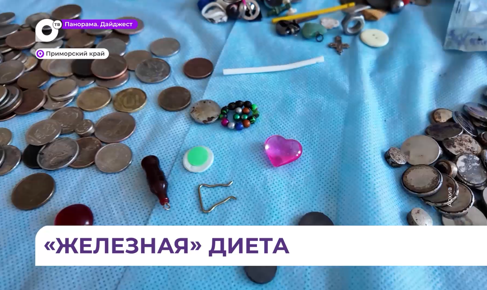  Магниты, цепи и дюбели: приморские врачи рассказали об опасных предметах, которые глотают