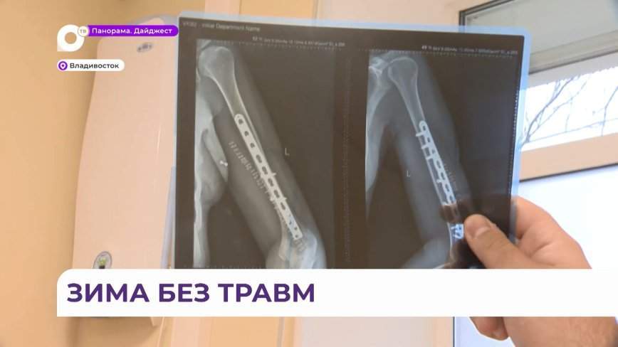 Врачи-травматологи Владивостока готовы ко встрече с зимой