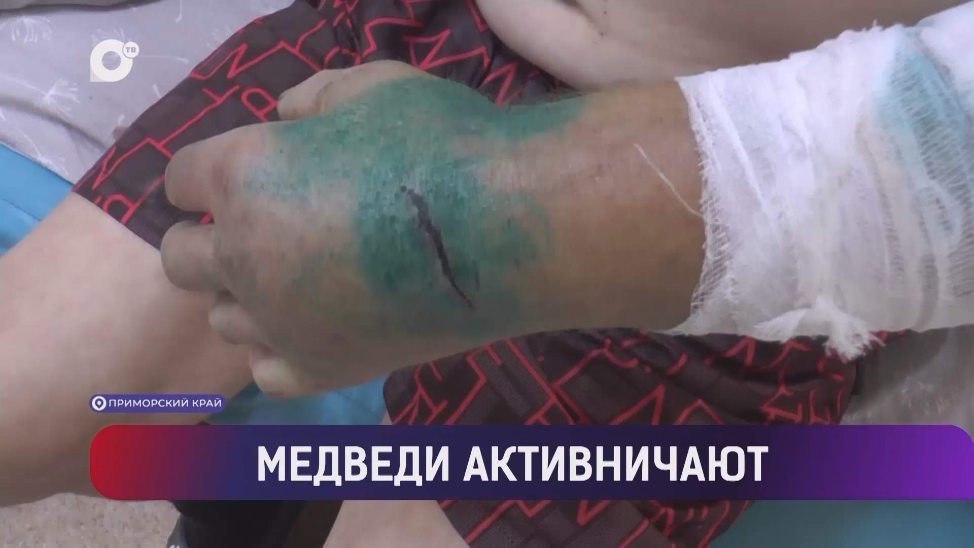 Выводы / Медвежьи активности: как не допустить встречи с косолапым / 10.10.26