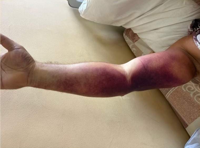 Сезон змей в Приморье собирает свои жертвы - фото и истории, от которых захватывает дух