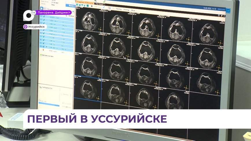 В Уссурийске открылся диагностический центр нового поколения с самым мощным оборудованием в Приморье