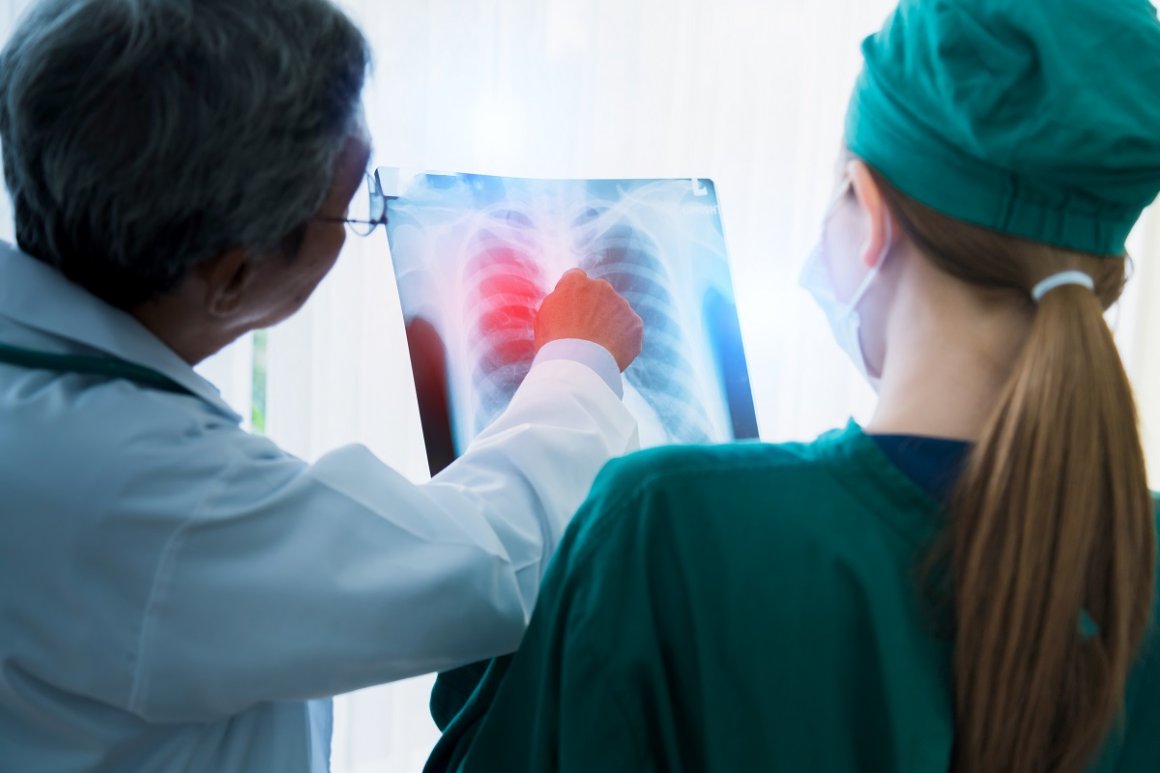 Неочевидные признаки рака лёгких назвали врачи