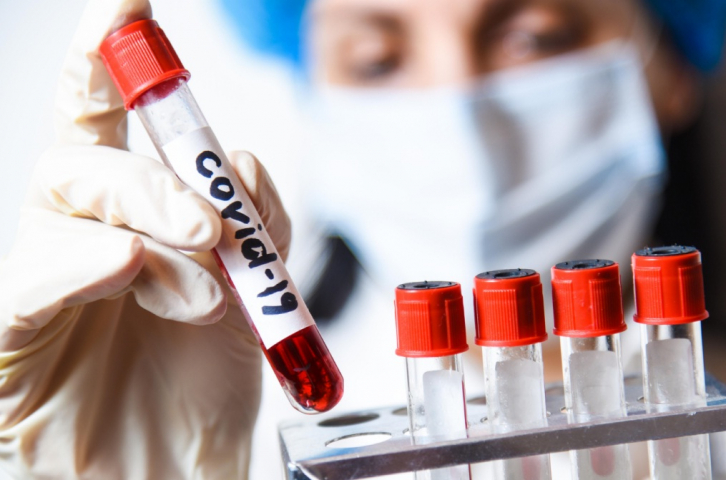 В Приморье выявили 125 новых случаев коронавируса