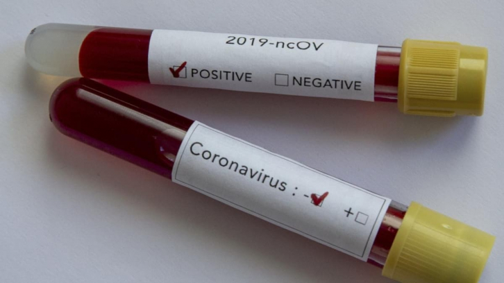 В Приморье за сутки 227 новых случаев коронавируса